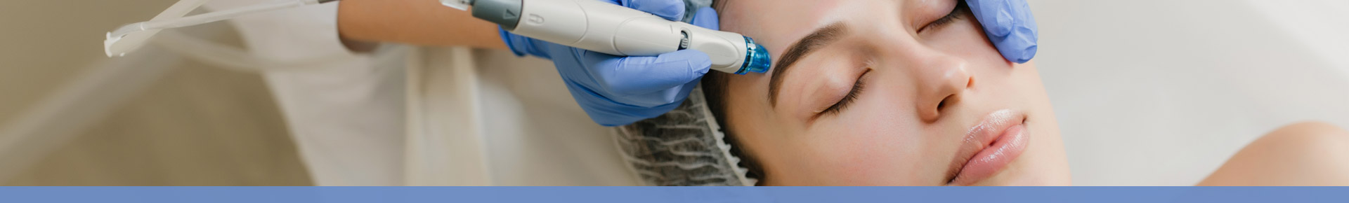 Trattamenti con LASER CO2